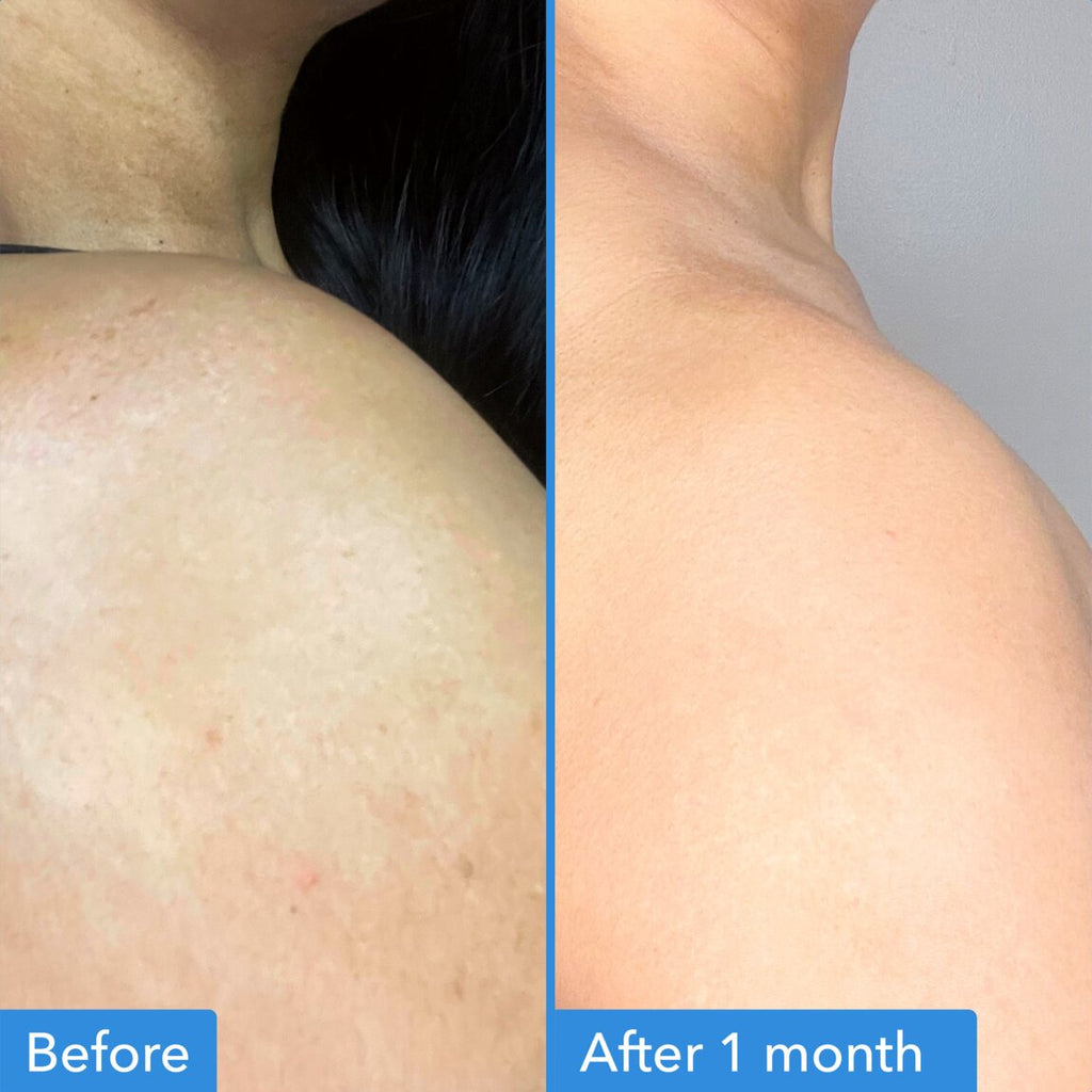 discoloration-correcting-body-treatment-n7 zb_p.jpg