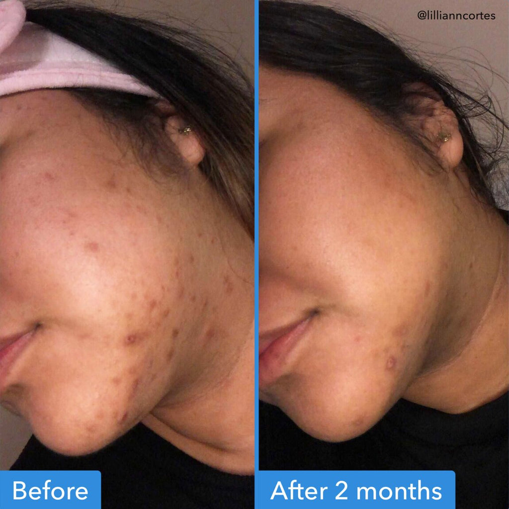 discoloration-correcting-serum-y5 zb_p.jpg