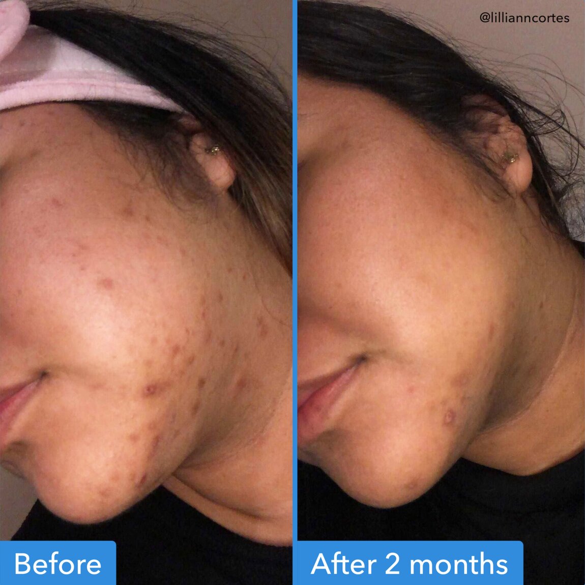 discoloration-correcting-serum-y5 zb_p.jpg