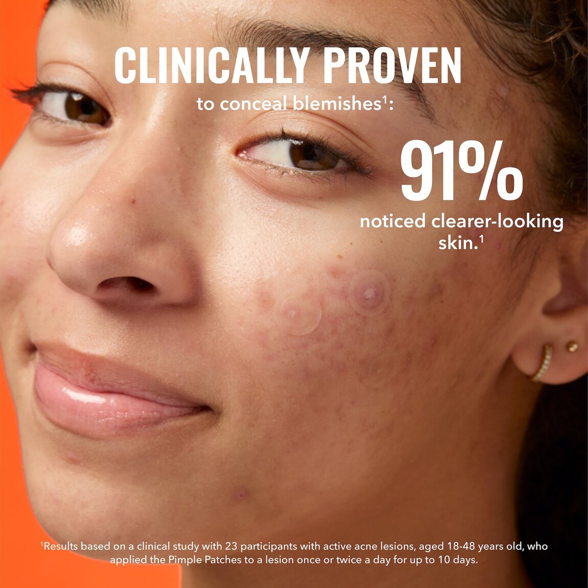 pimple-patches-b4 zb_p.jpg