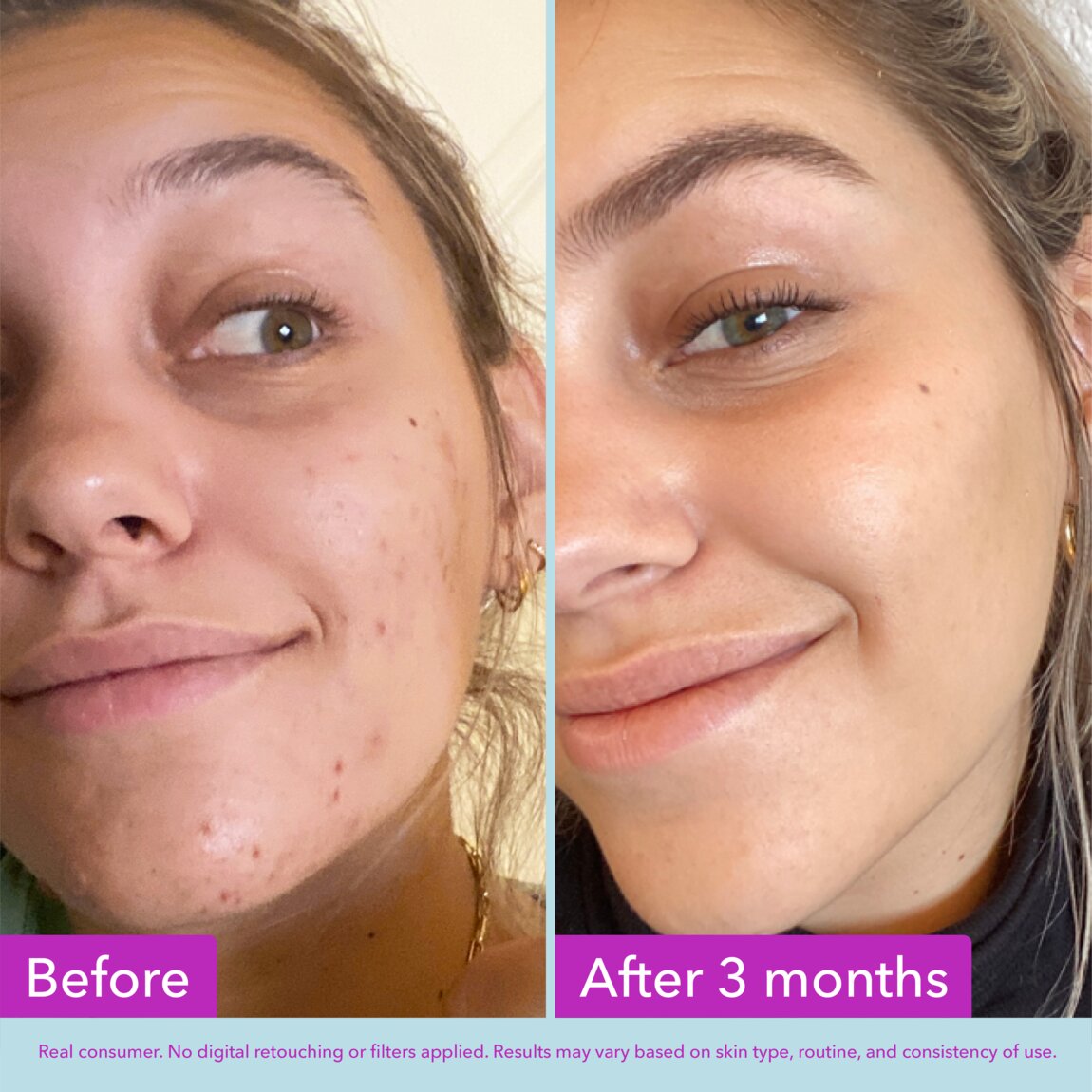 niacinamide-brightening-toner-b0 zb_p.jpg